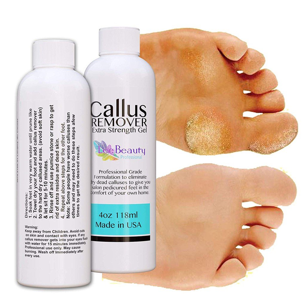 Callus Remover for Feet